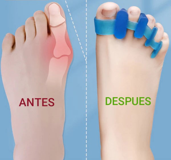 Miniatura 3 de Separador de silicona para dedos FK24-07